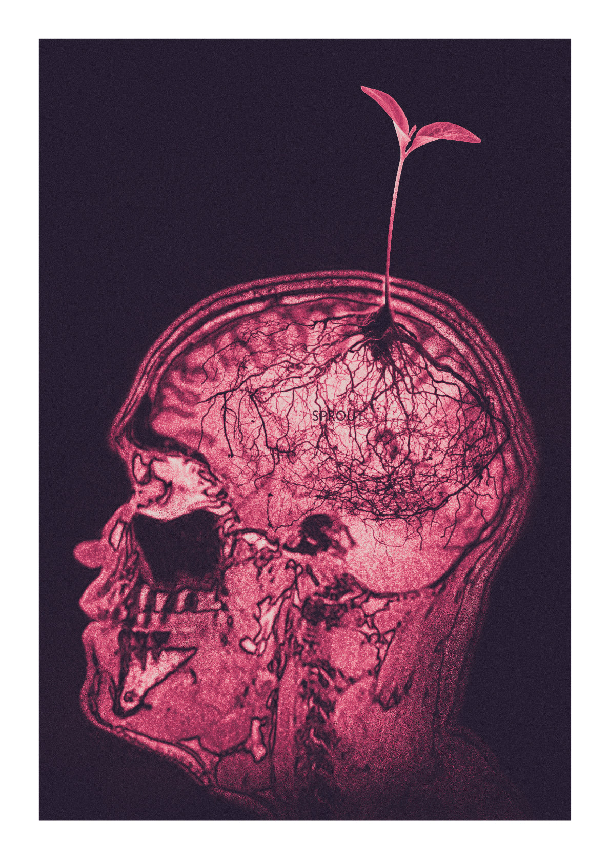 SPROUT