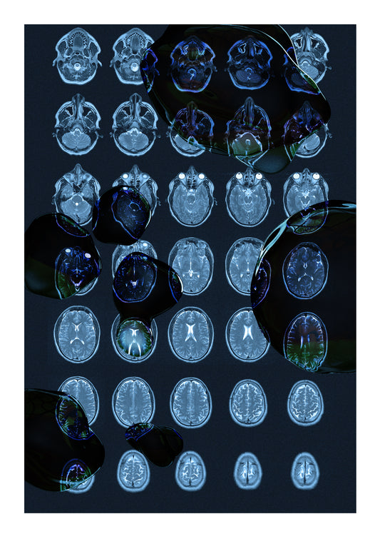 Brain scan - 01